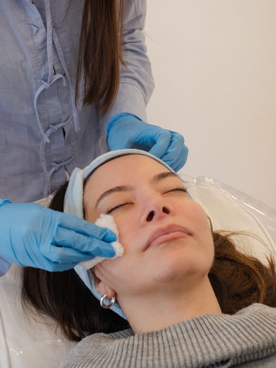 Aplicación de mesoterapia facial con un algodón de apoyo
